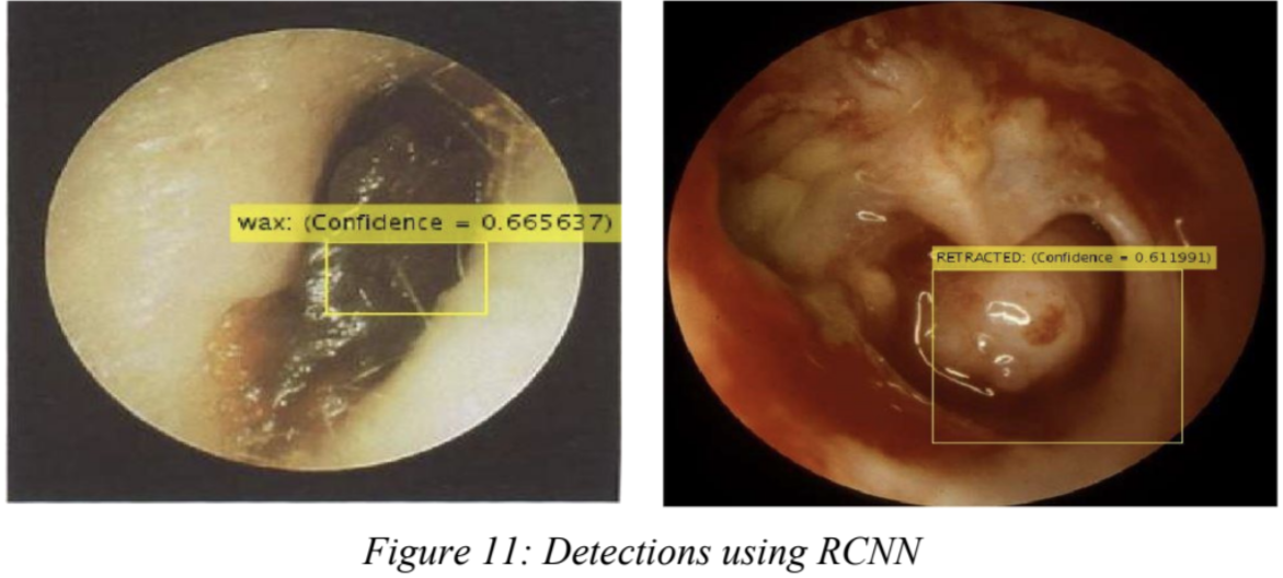 RCNN Detection Results